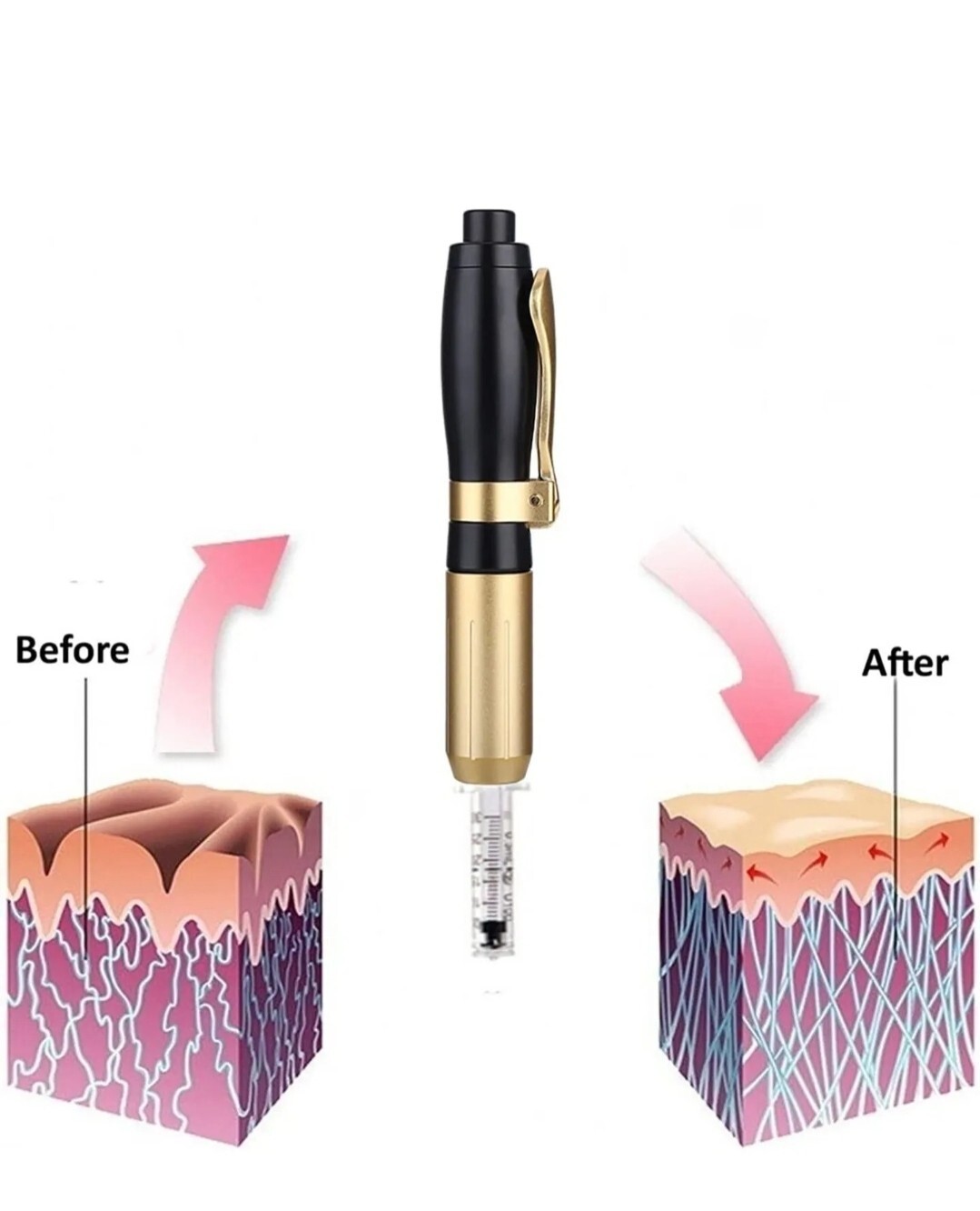 Continuous Mist Gun Needle Free Atomizer