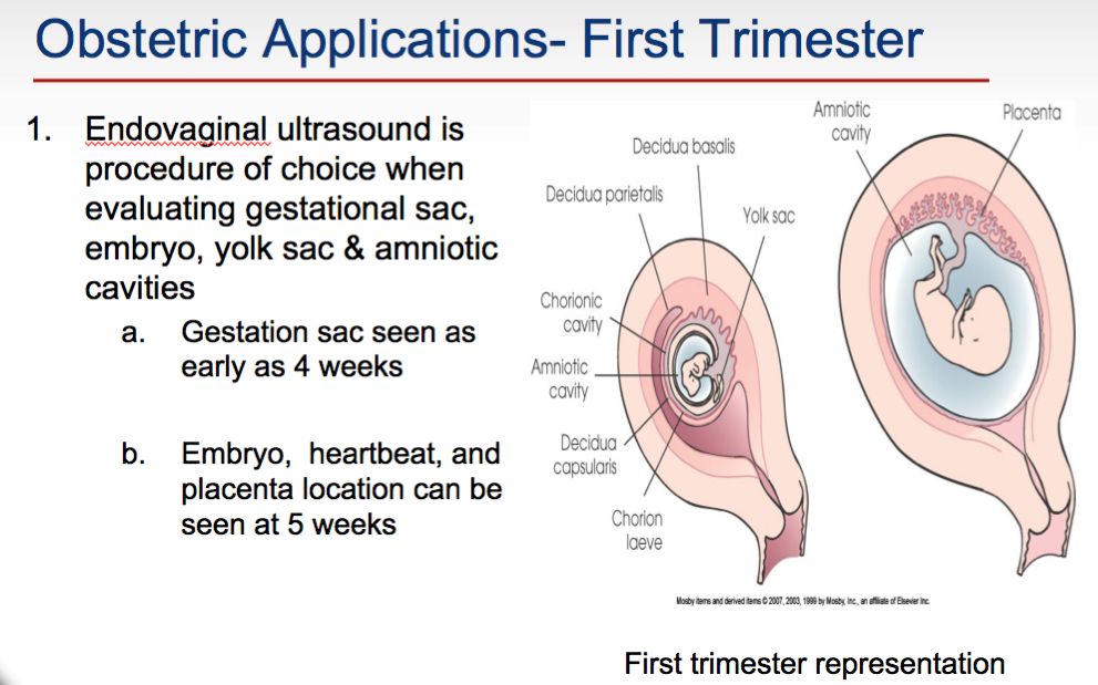50 page SONOGRAPHY PowerPoint Presentation on CD