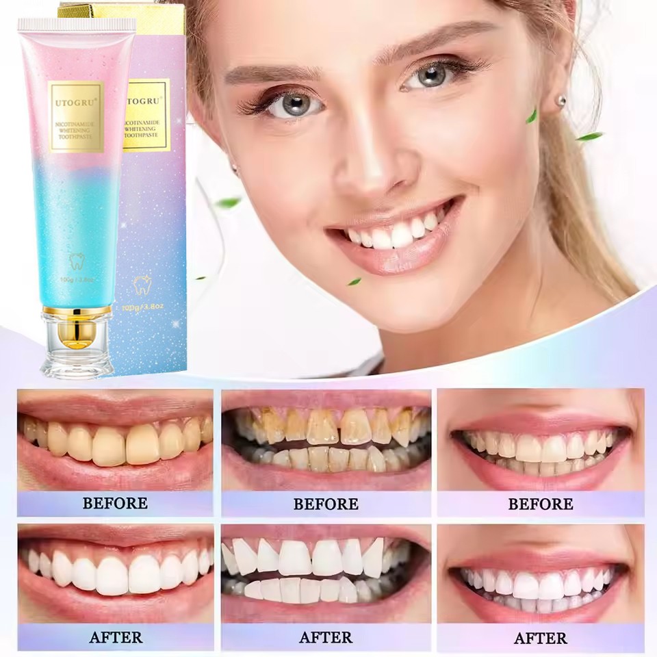 Nicotinamide Dazzling Whitening Toothpaste Nicotinamide Formula,Fresh Breath