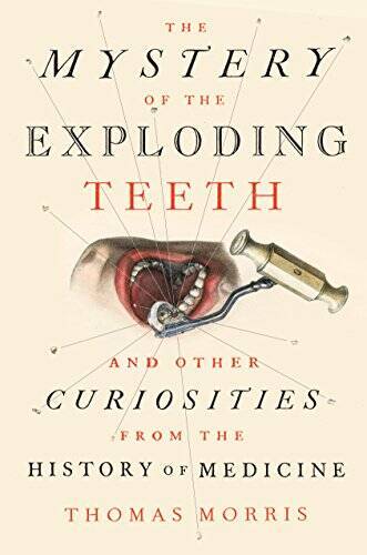 The Mystery of the Exploding Teeth: And Other Curiosities from the Histor - GOOD