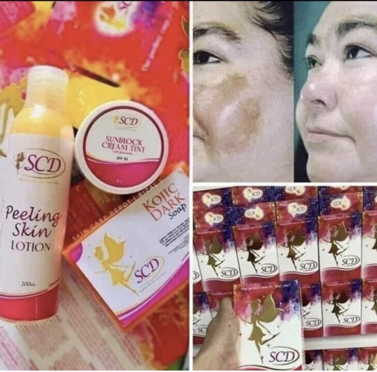 SCD Peeling Set