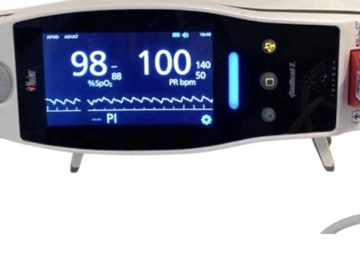 Masimo Radical 7 Pulse Oximeter