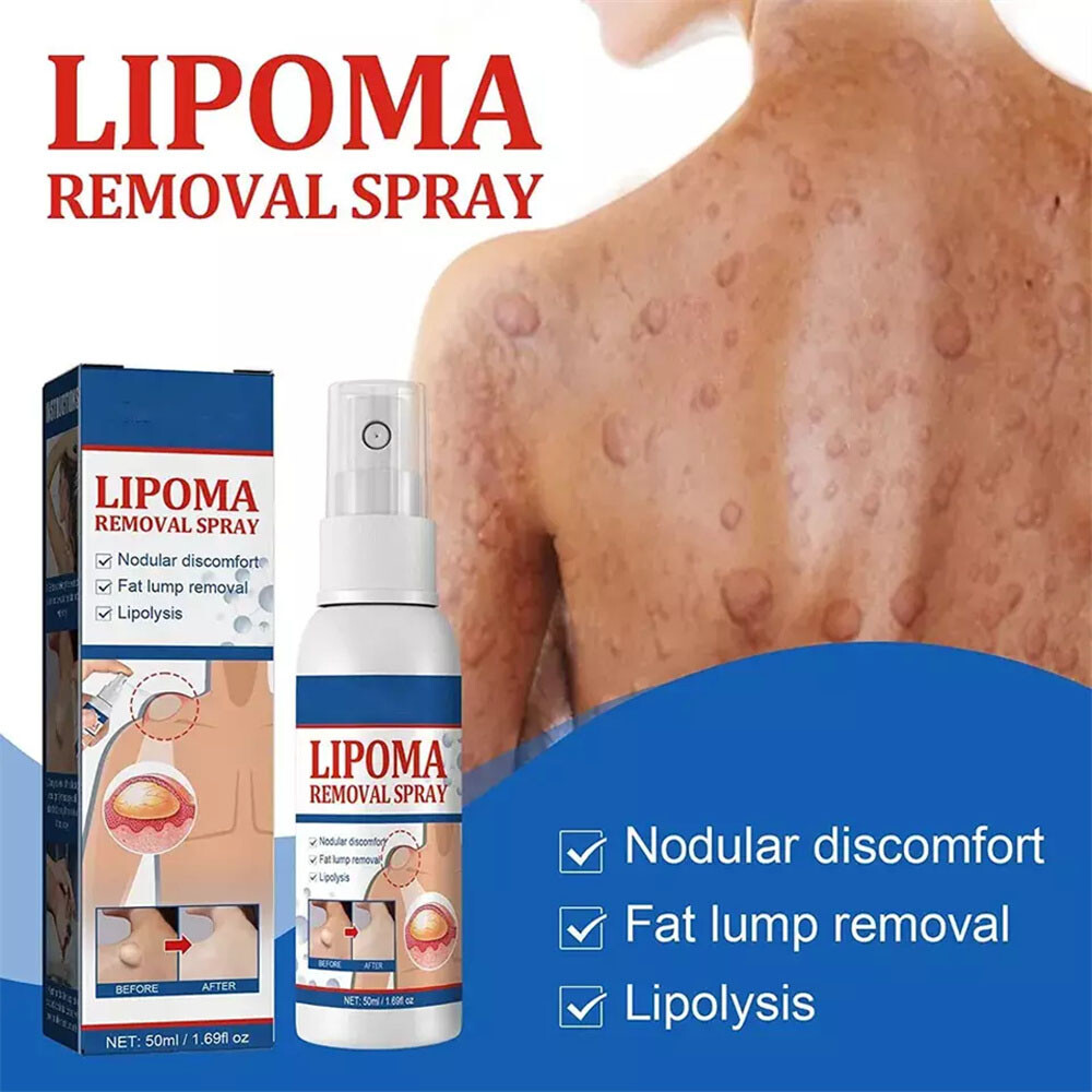 2PCS Lipomheilung Reduction Spray, Instant LumpFree Lipoma Removal Spray USA Hot
