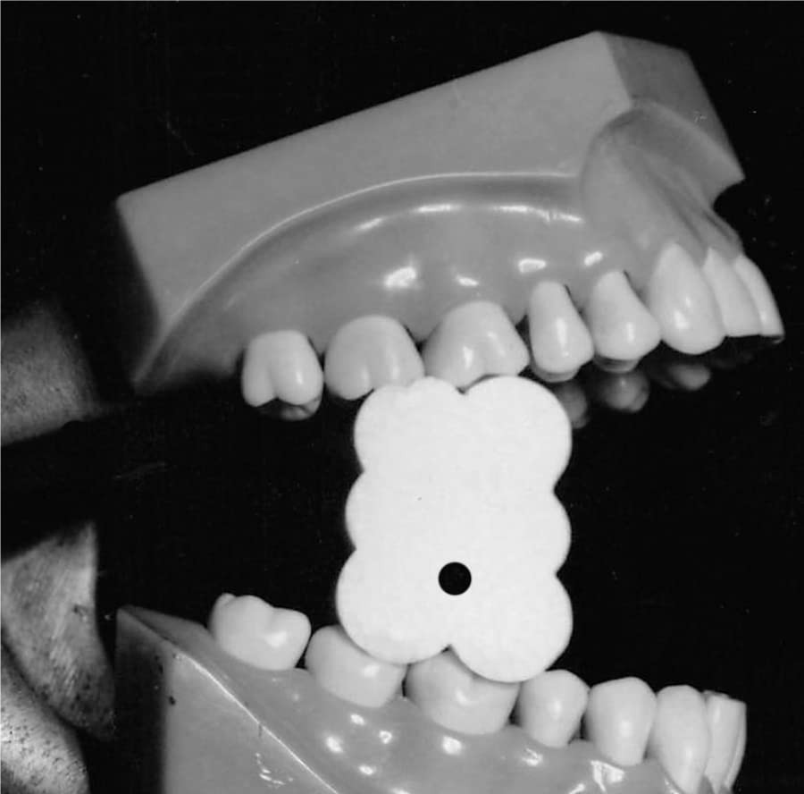 EZ Prop ­® Disposable Mouth Prop - 100 Count