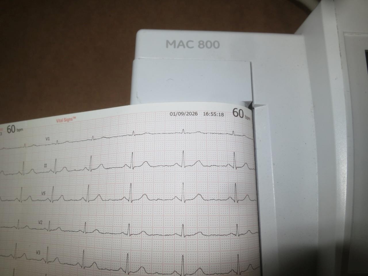 GE MARQUETTE MAC 800 EKG ECG INTERPRATIVE GUARANTEED