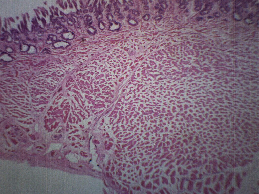 Frog Tongue - CS - Prepared Slide - 75x25mm - Eisco Labs