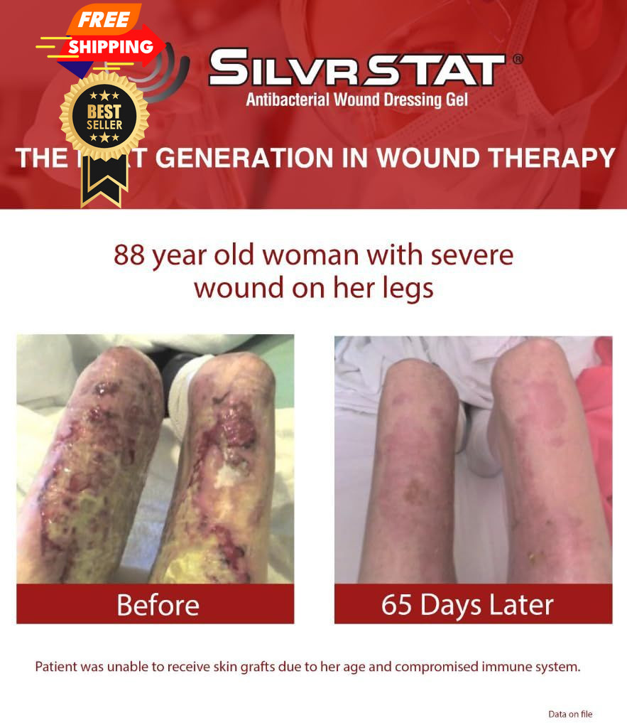 SilvrSTAT First Aid Kit Gel, 32 PPM Silver Healing Wound Dressing 3 Ounce