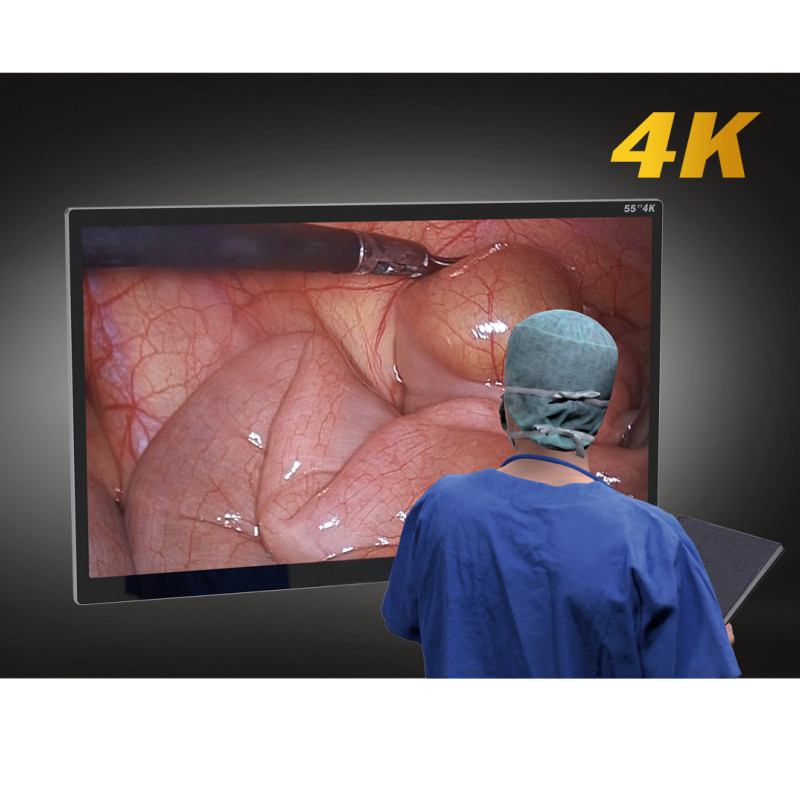 4k Endoscopy Laparoscopic Camera System Ultra HD Endoscope Camera Multiple surg