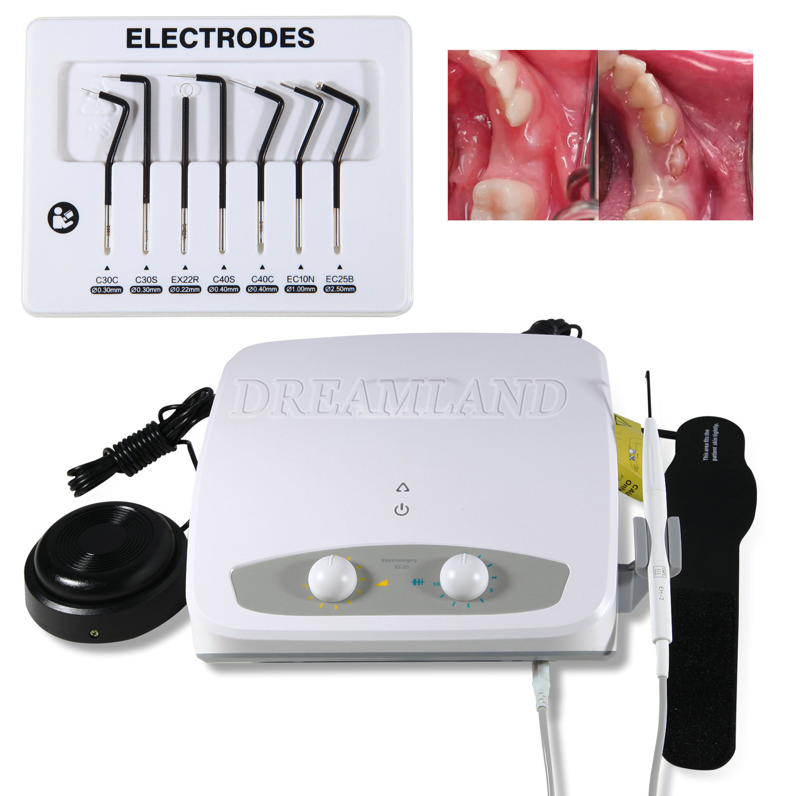Dental Electro Electrosurgery Unit Machine High Frequency Electric 7pcs Knife