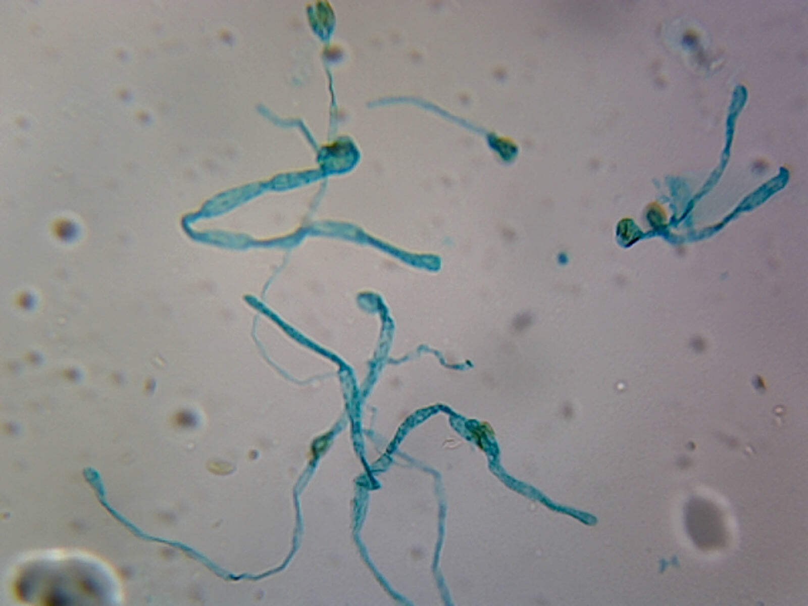 Moss Protonema; Whole-mount