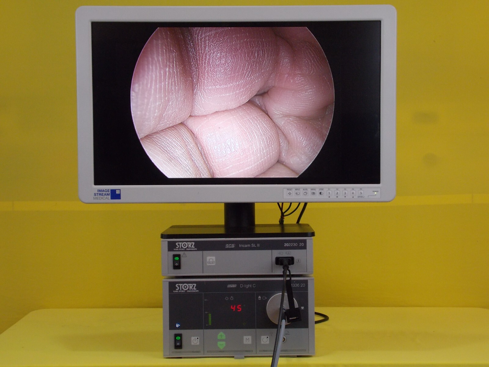 Storz PDD CYSTOSCOPY Tricam 20223020/20133620/20221137/495FS/ISM 26"HD Monitor