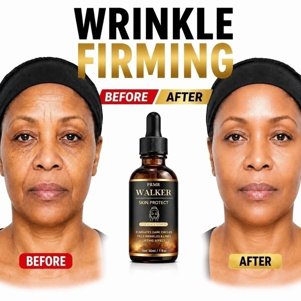 Original Walker Skin Protect Serum Black Women Gentle Facial Skin Care Moistu