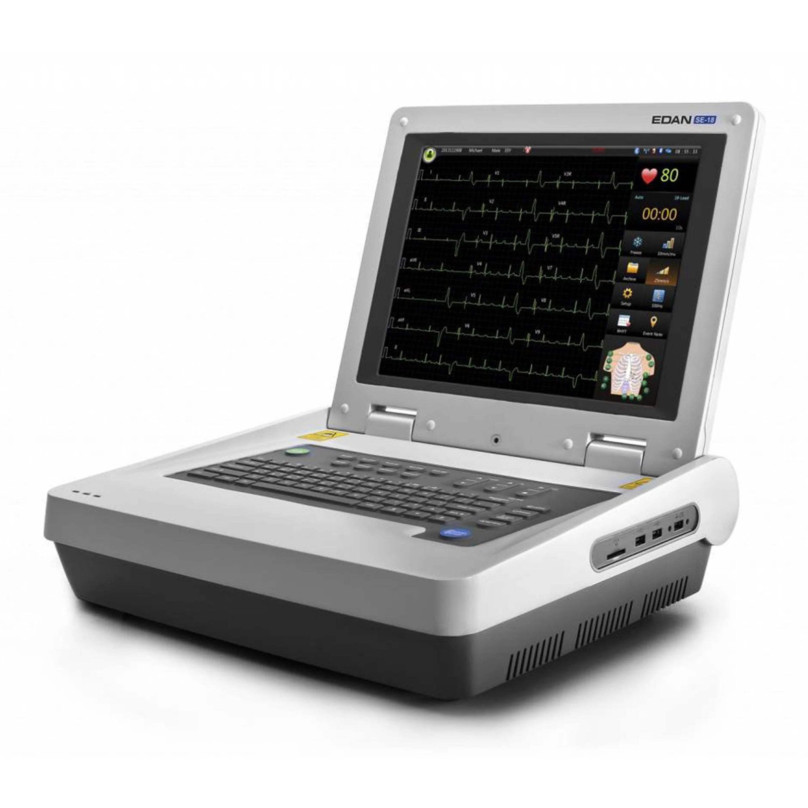 Edan SE-18 ECG Software Update