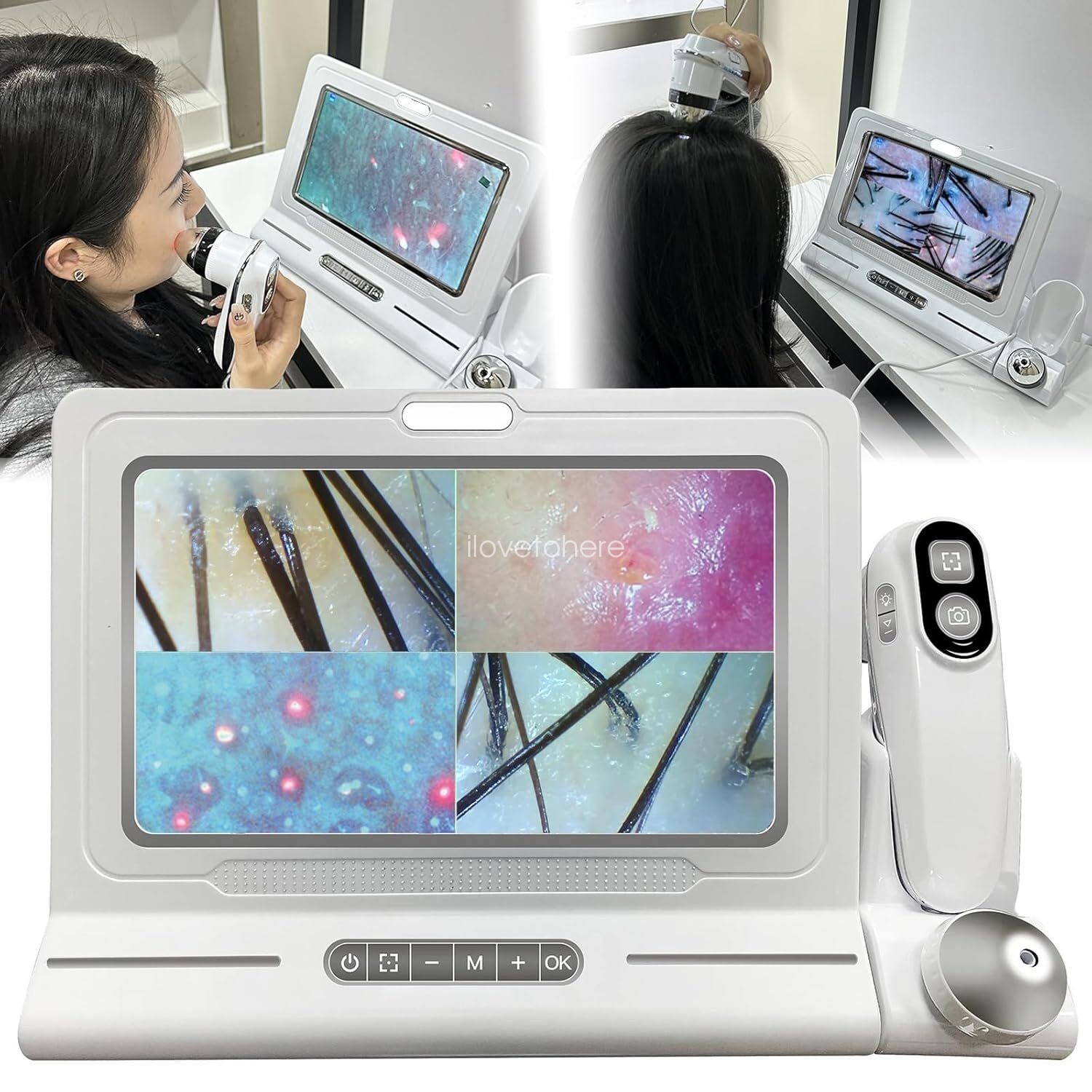 2026 Professional Home Use Skin Diagnosis Hair Analyzer Hair Scalp Detector USA