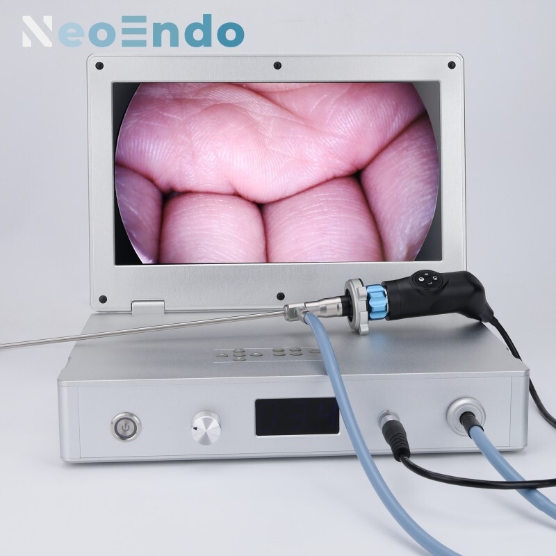 HD Portable Medical Endoscope Camera With 15.6 Inch Monitor 80W Light Source