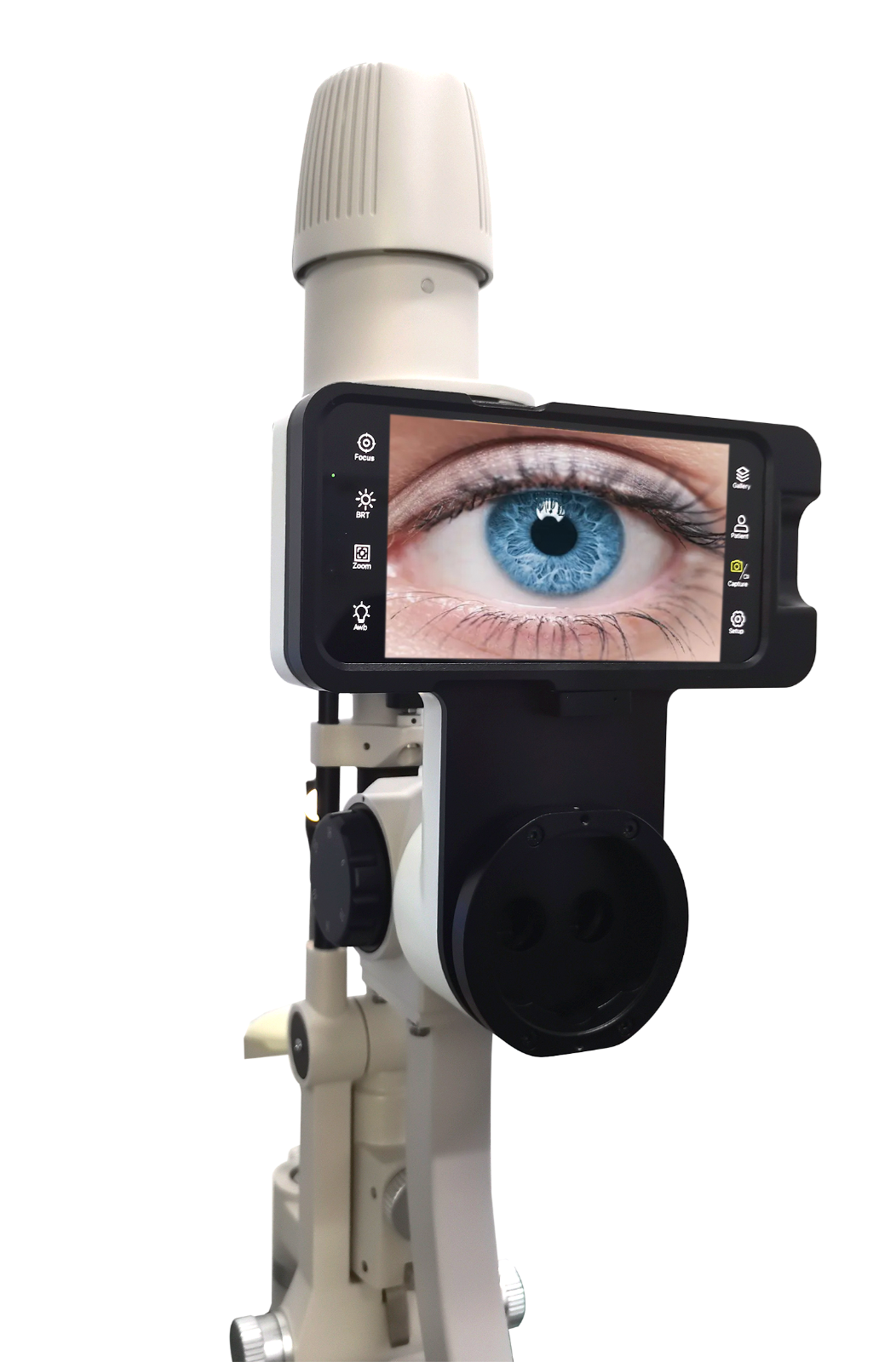 AIO Imaging Optic System Slit lamp Adapter For Topcon Nikon Reichert & More