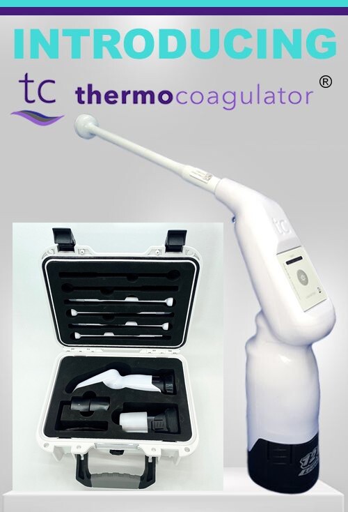 Thermal coagulator for the treatment of cervical pre-cancers in Womans