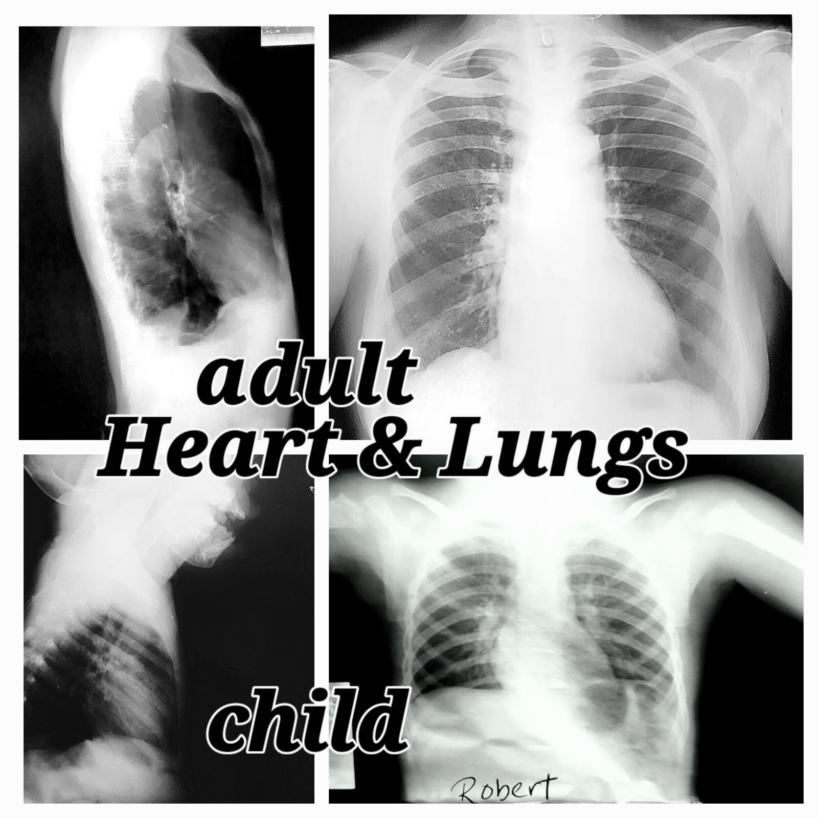 TEACHERS/EDUCATORS - REAL X-RAYS OF THE CHEST & ABDOMEN OF ADULTS AND CHILDREN