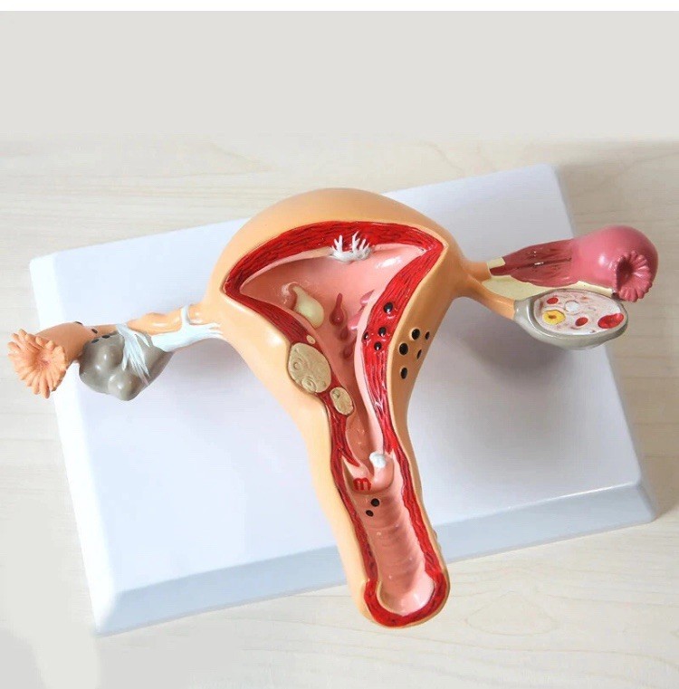 Model Human Female Uterus and Ovary Anatomical Anatomy Medical Pathological