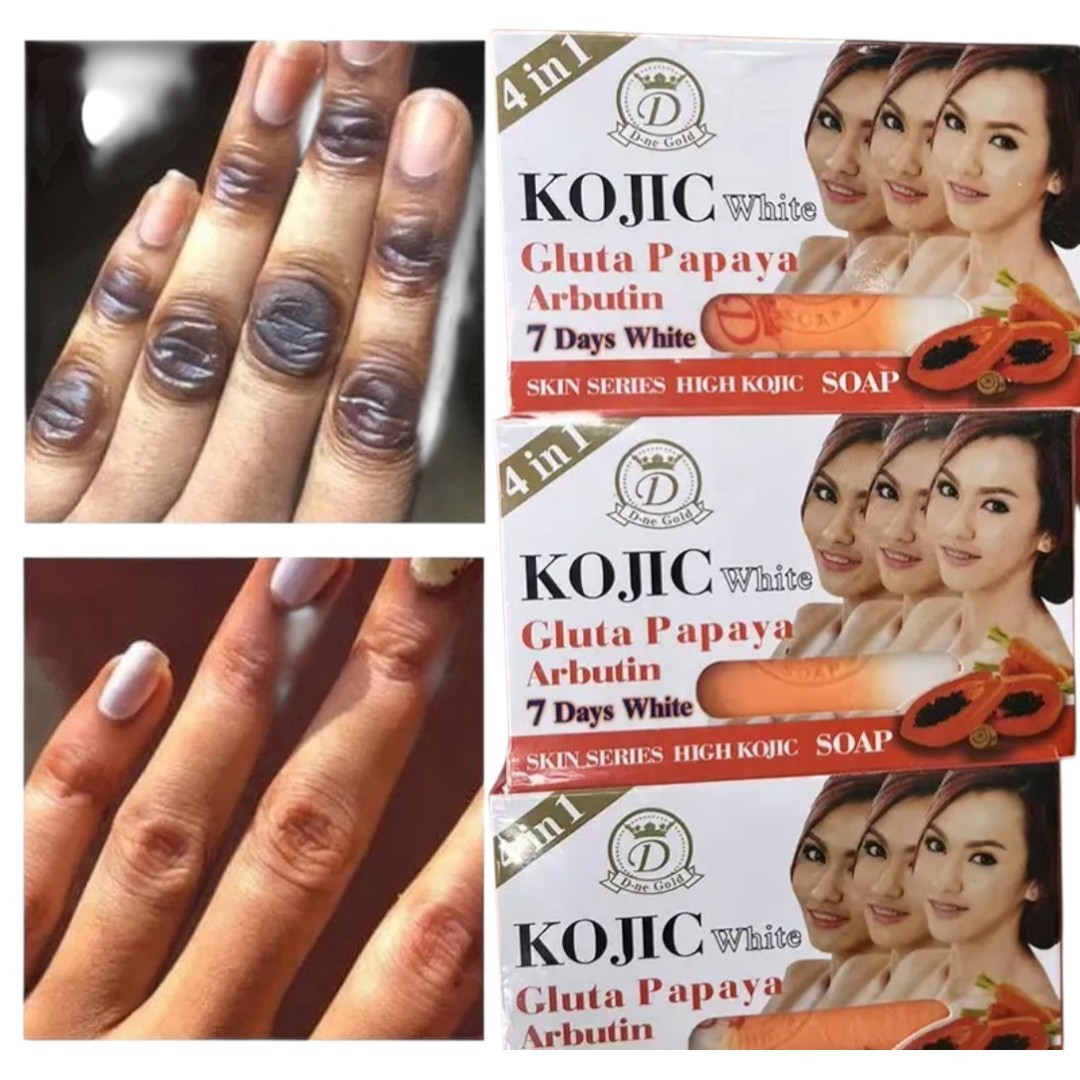3-Pk Kojic Arbutin Brightening Bar Soap Skin Dark Spot Remover 160g [USA Stock]