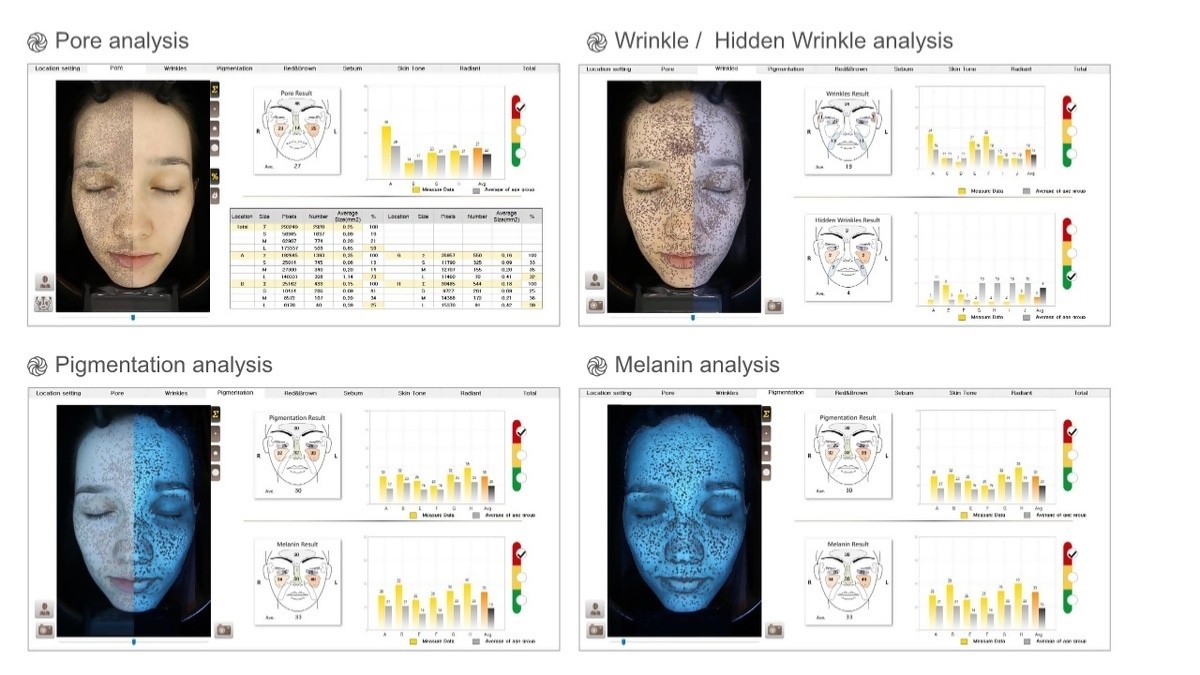 GLIMPSE – PROFESSIONAL SKIN ANALYZER 2024