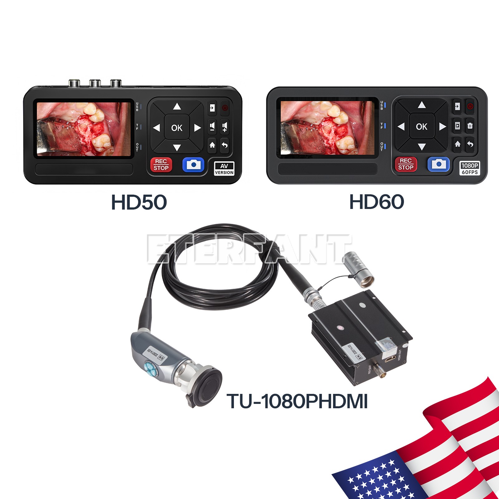 1080p Full HD Endoscopy Camera/Surgical Recorder For Medical ENT Laparoscopy