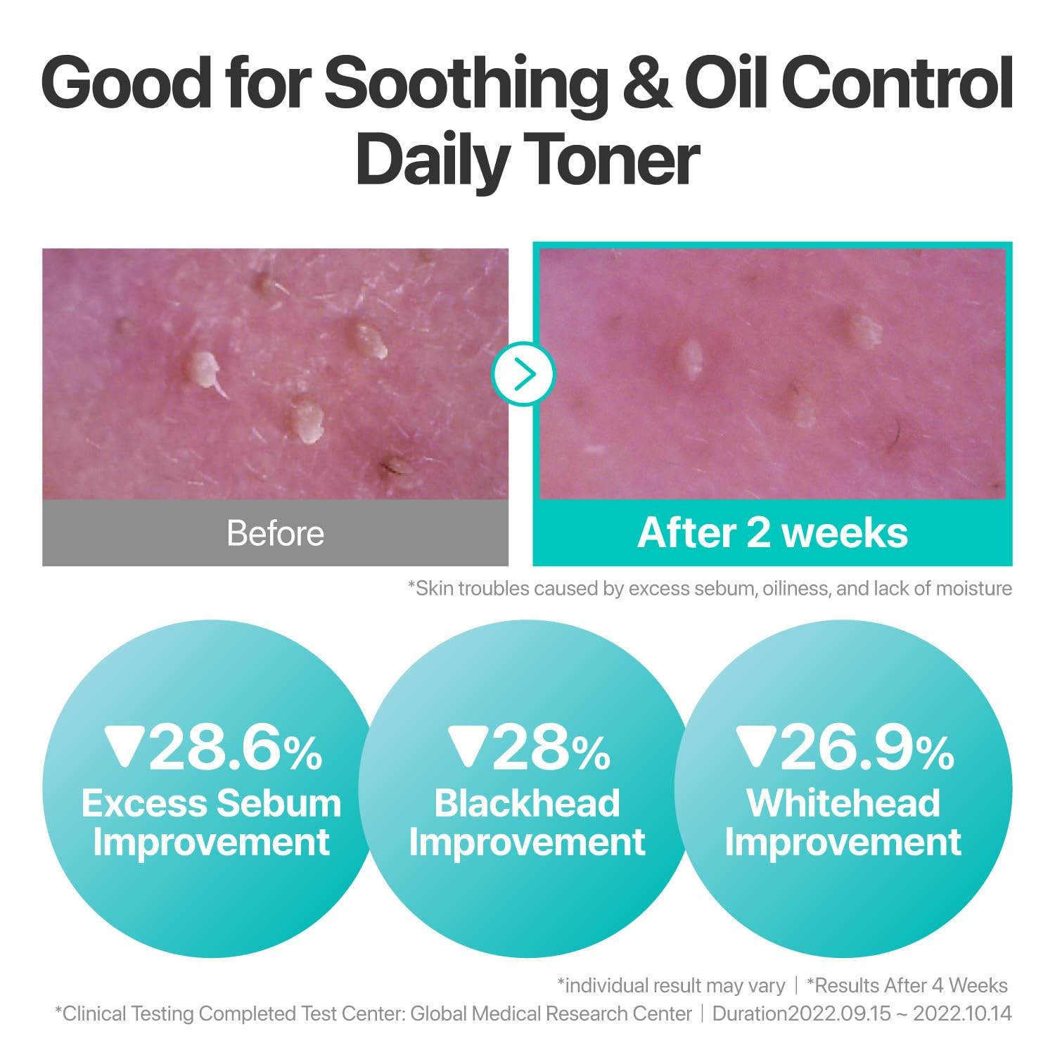numbuzin No.1 Toner | Pure-Full Calming Herb Toner | Breakouts, Redness, Excess