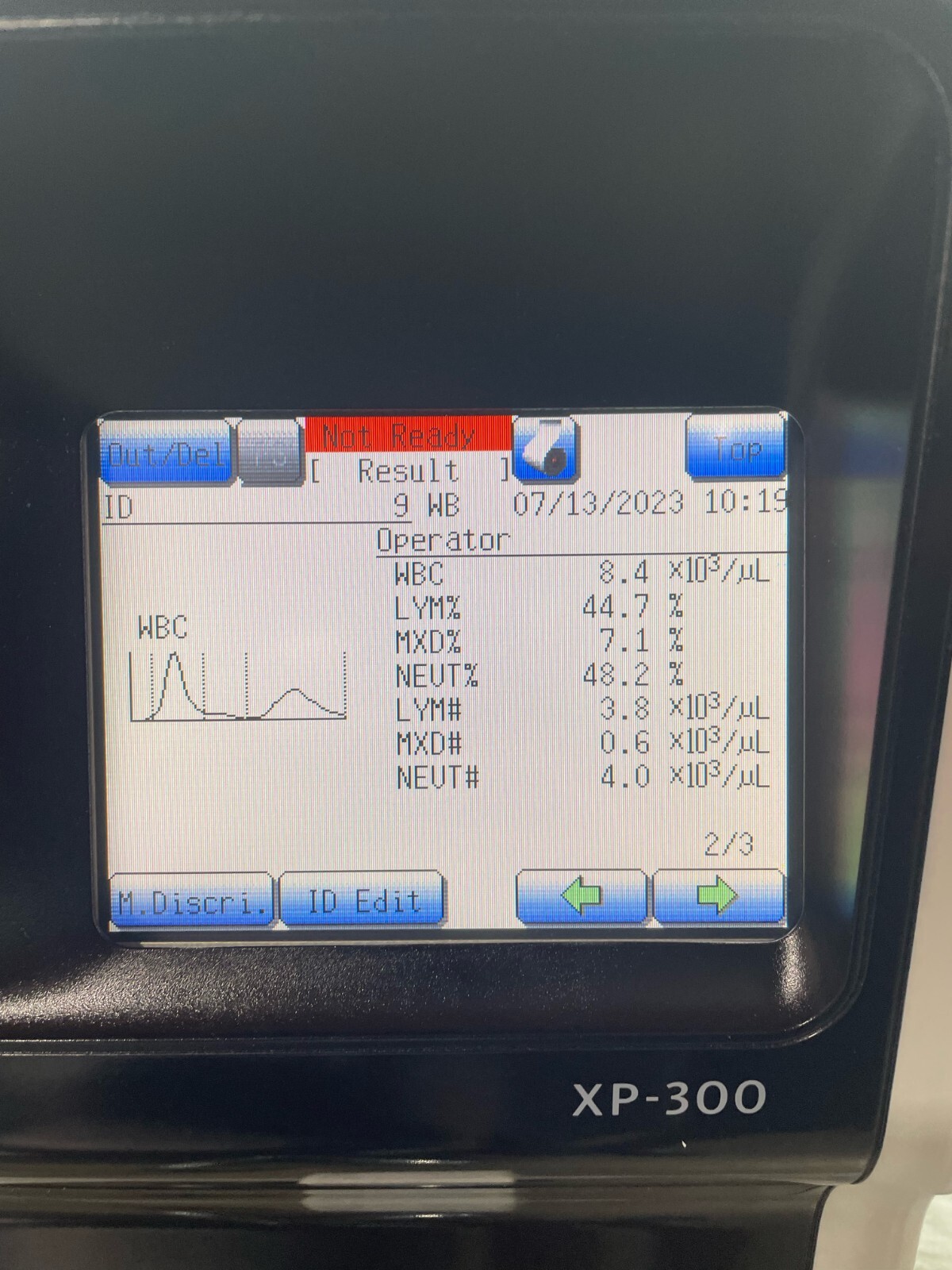 Sysmex XP-300 Automated Hematology Analyzer