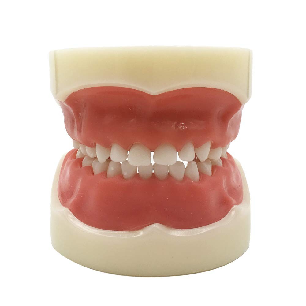 Typodont Child Teeth Model 24 PCS Removable, Teaching Study Kilgore Nissin Fit