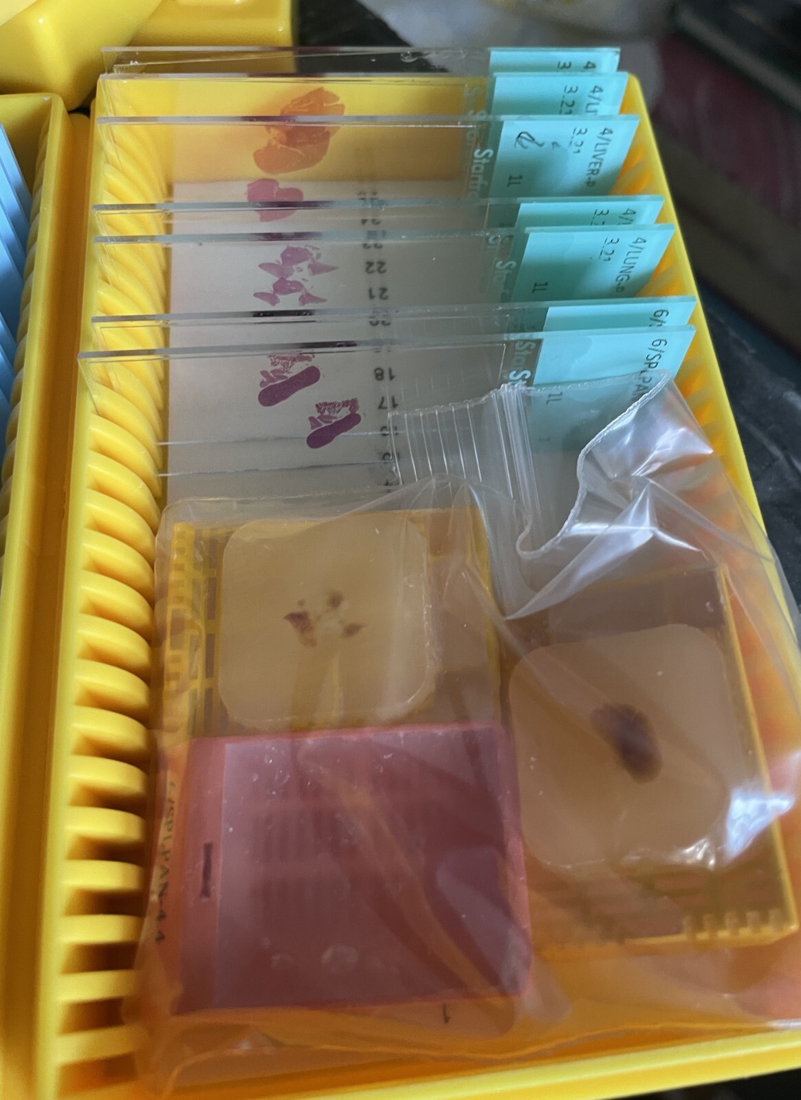 Microscope storage boxes with mouse tissues slides