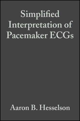 Simplified Interpretation of - Paperback, by Hesselson Aaron B. - Very Good