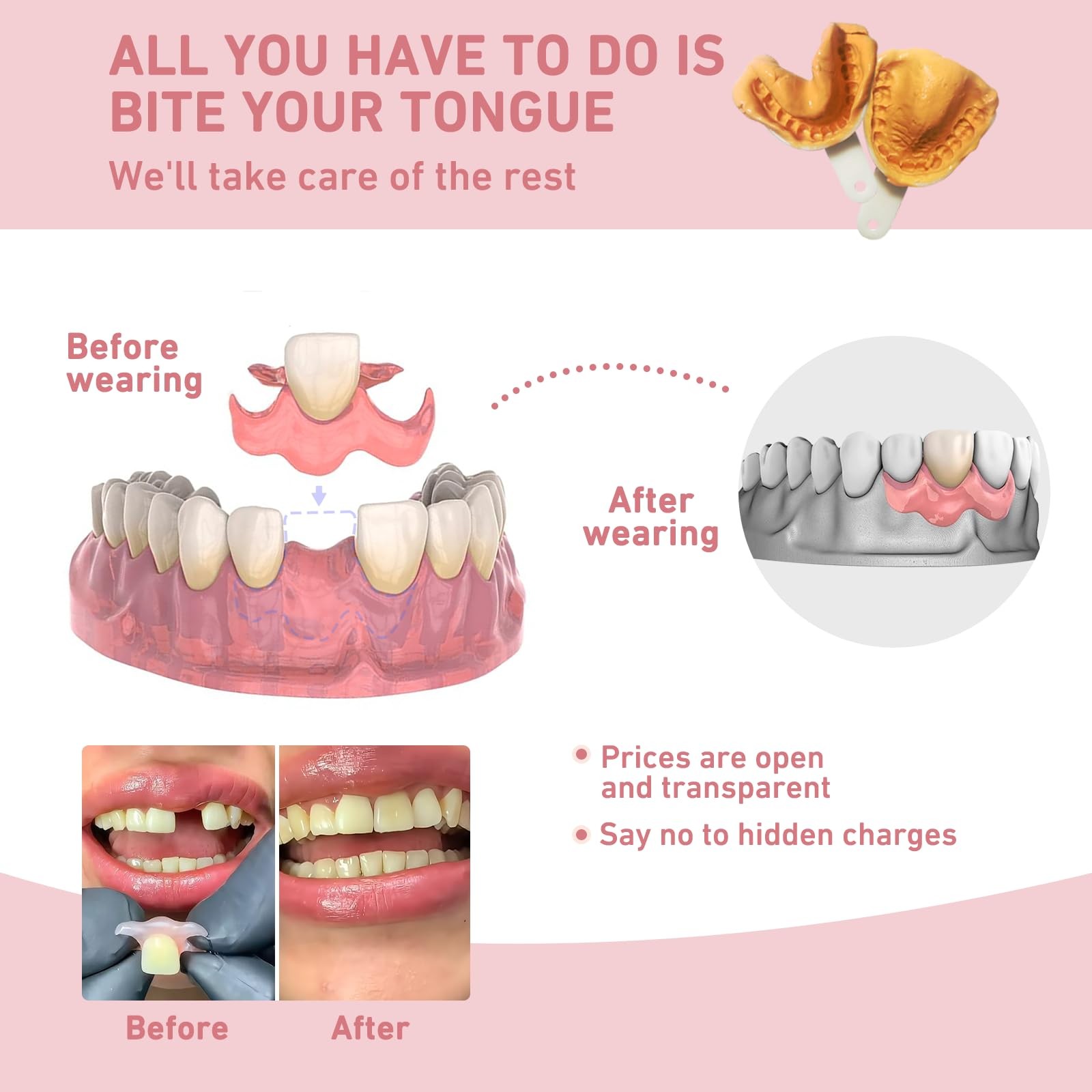 Custom Partial Dentures – Personalized Removable Denture Set for Missing Teet...