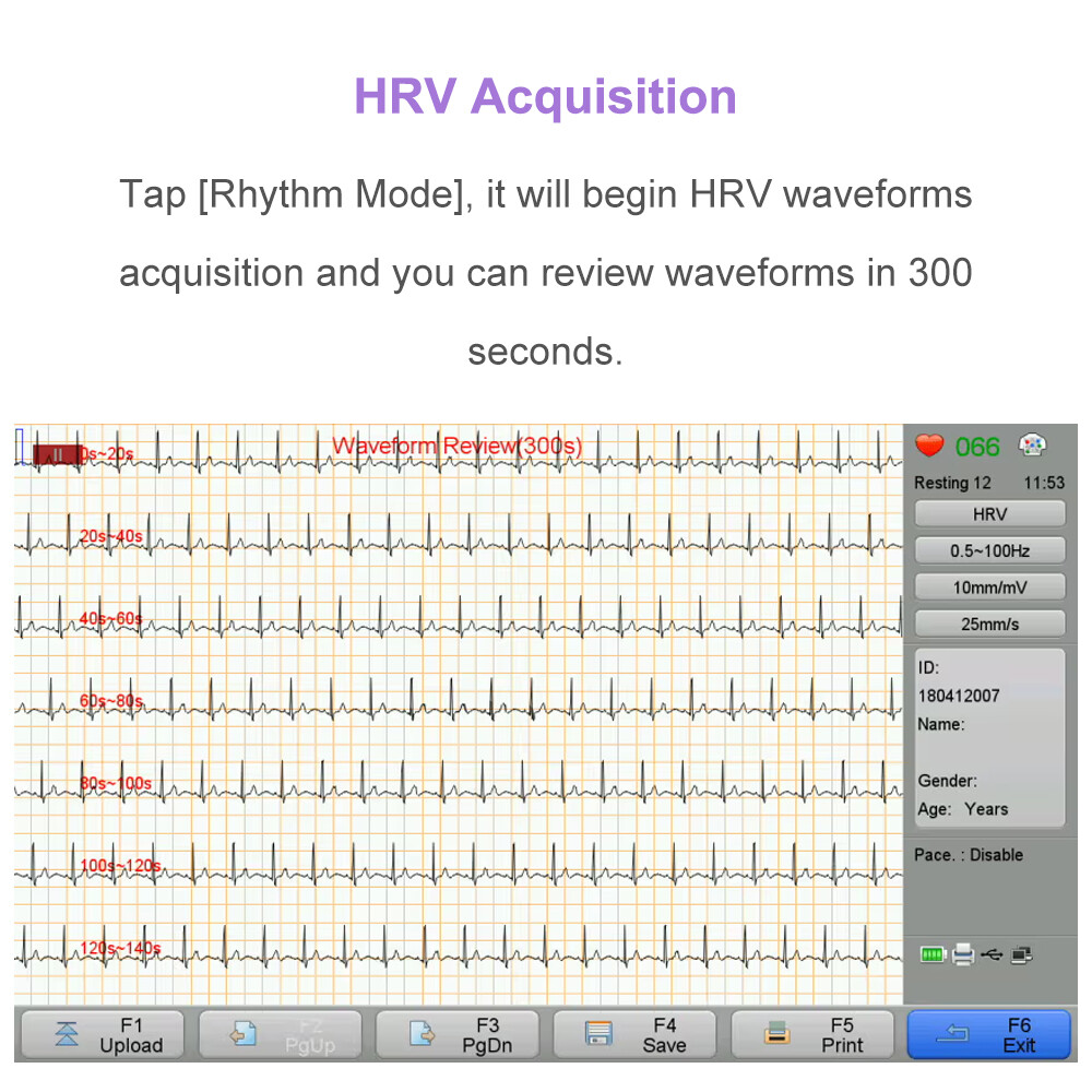 12 channel ECG Machine with interpretation for advisory diagnosis FDA approved