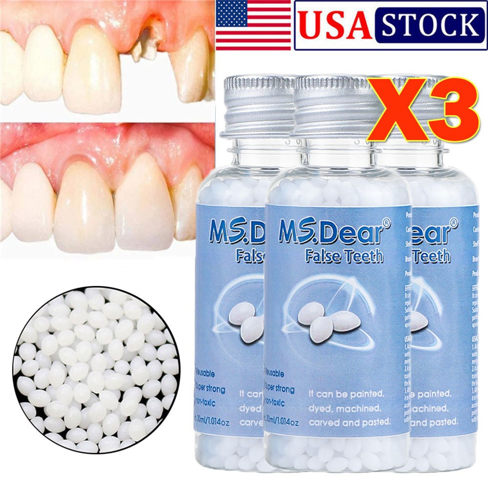 3X Tooth Repair Kit - Temporary Teeth Replacement Kit for Missing & Broken Teeth