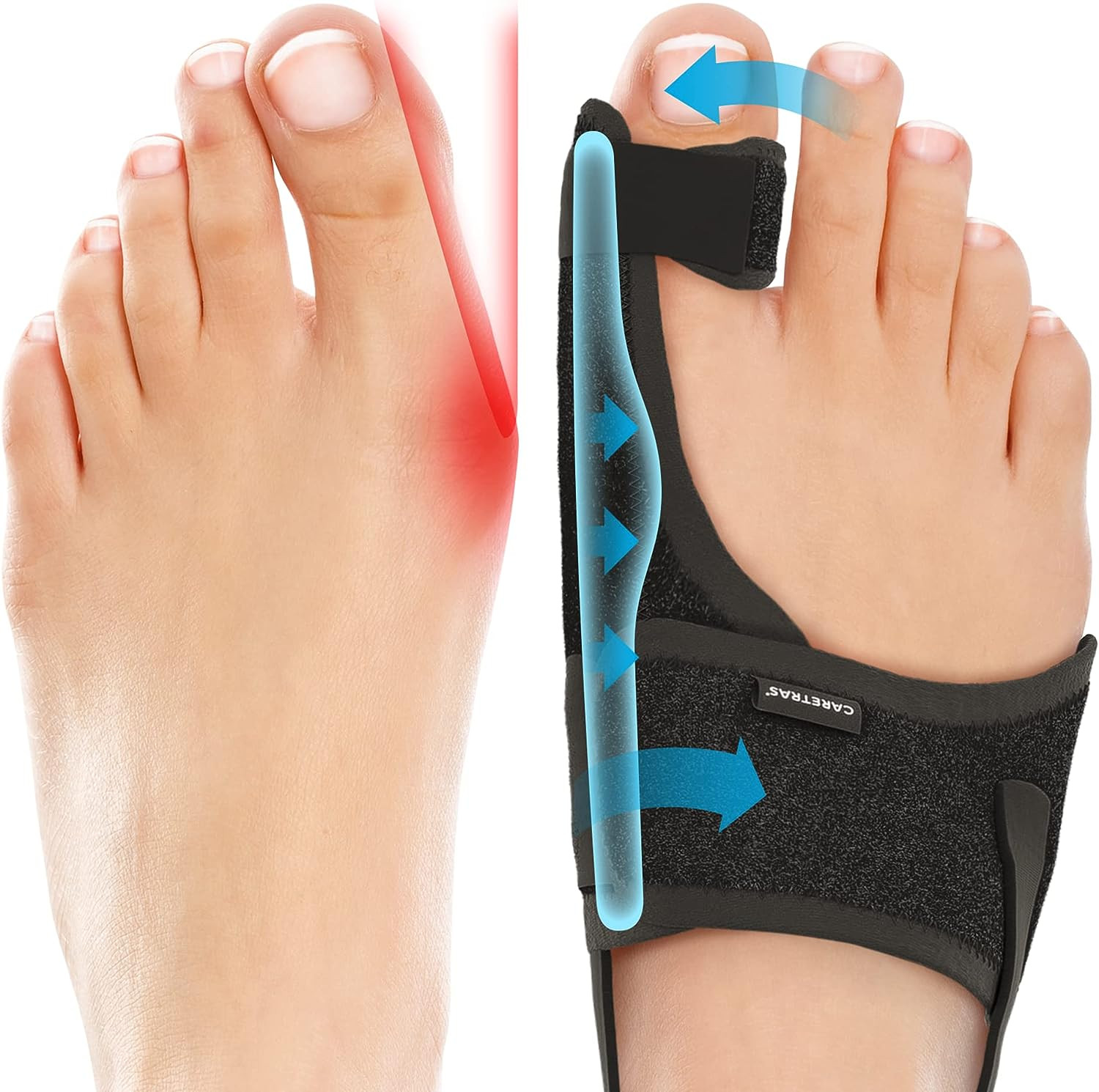 2-Pack Bunion Corrector for Women & Men, Orthopedic Bunion Splint for Hallux Val