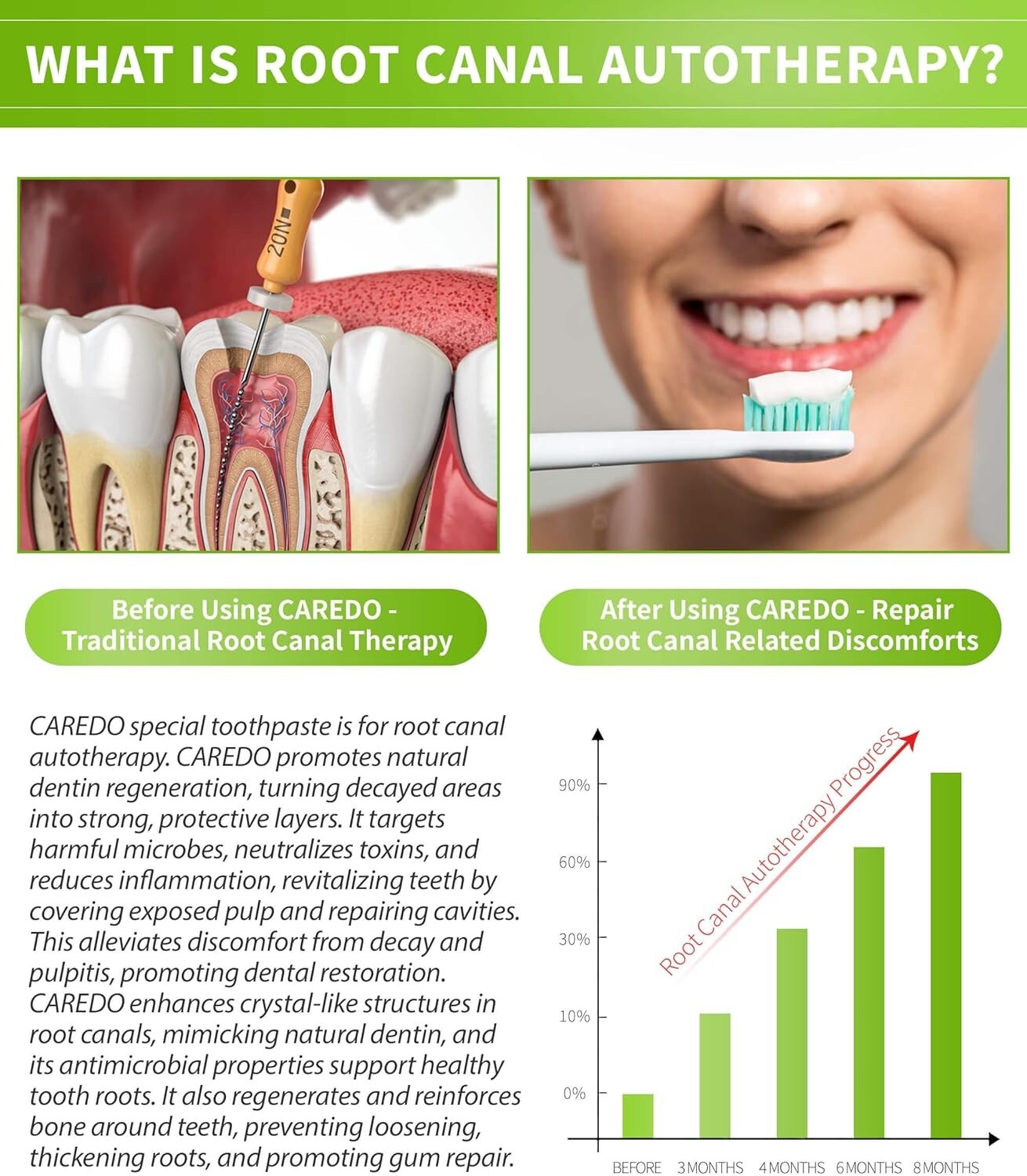 CAREDO Root Canal Toothpaste for Sensitivity Relief, Gum & Enamel Repair, 3.52oz