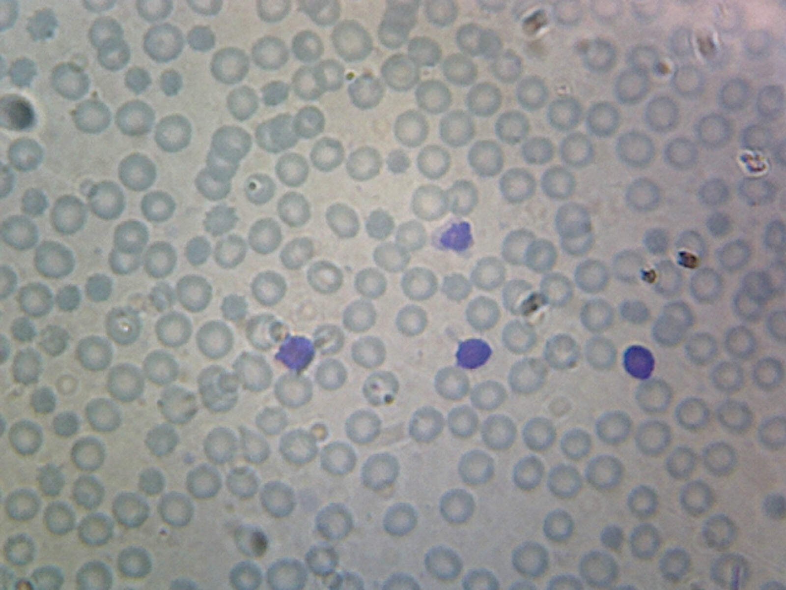 Human Blood; Smear; WR Stain