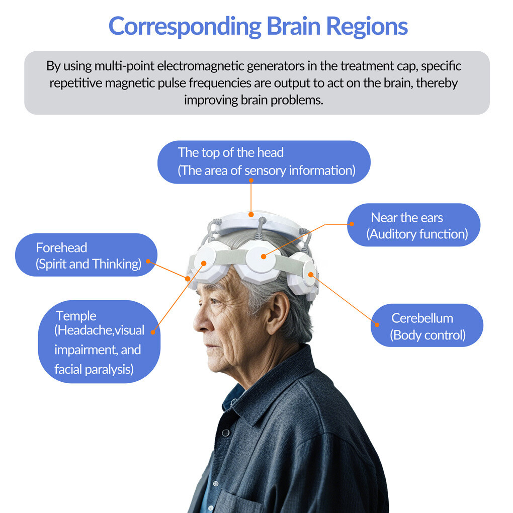 rTMS Therapy Transcranial Magnetic Stimulation Treatment Resistant Depression US