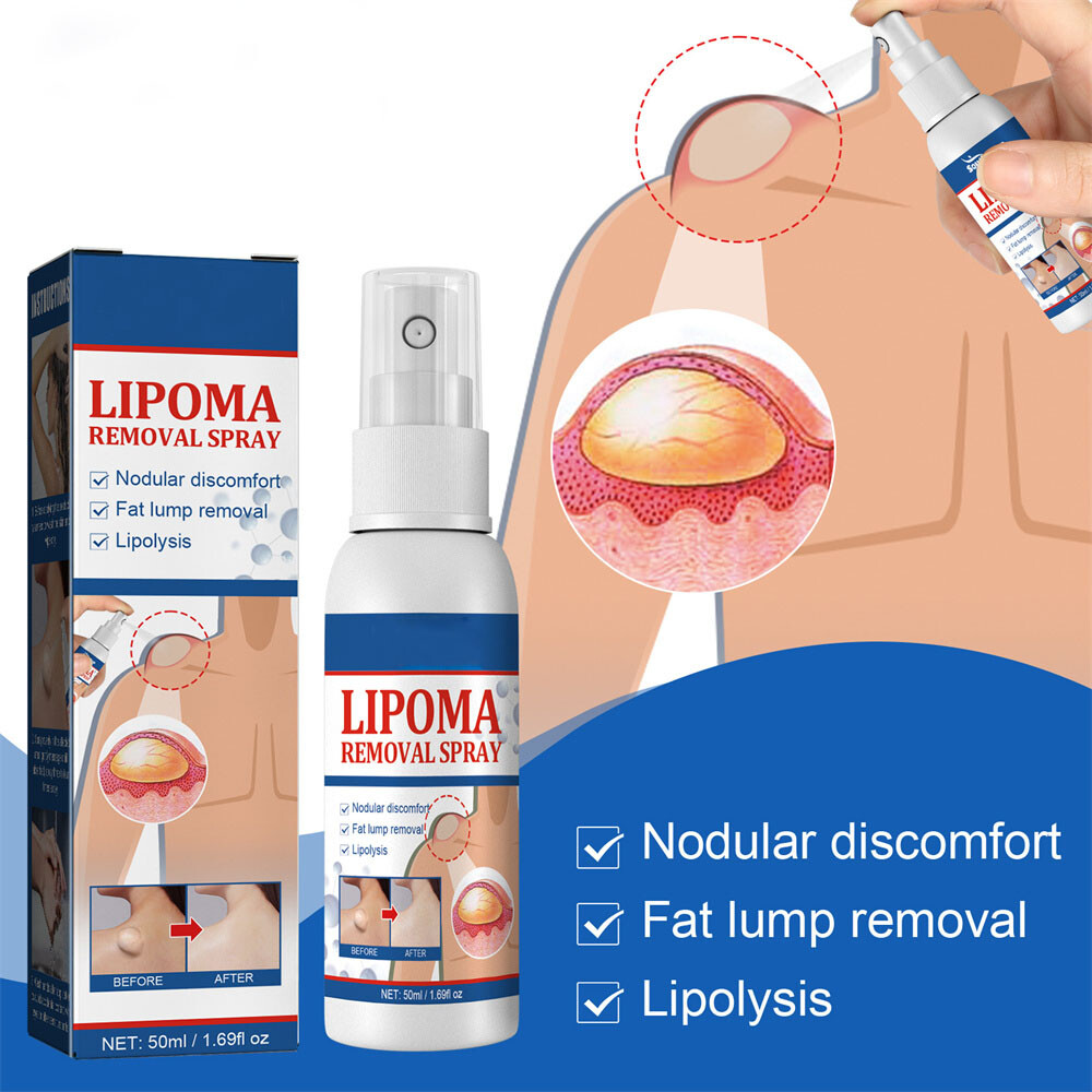 2PCS Lipomheilung Reduction Spray, Instant LumpFree Lipoma Removal Spray USA Hot