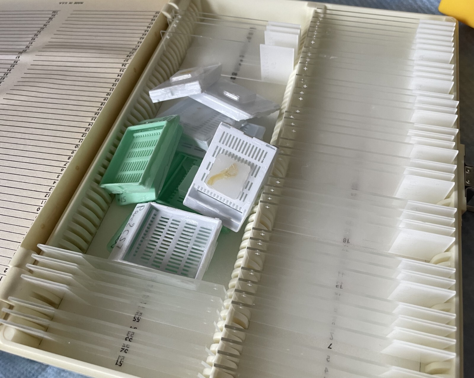 Four Microscope storage boxes with mouse tissues slides, 14,15,16,17