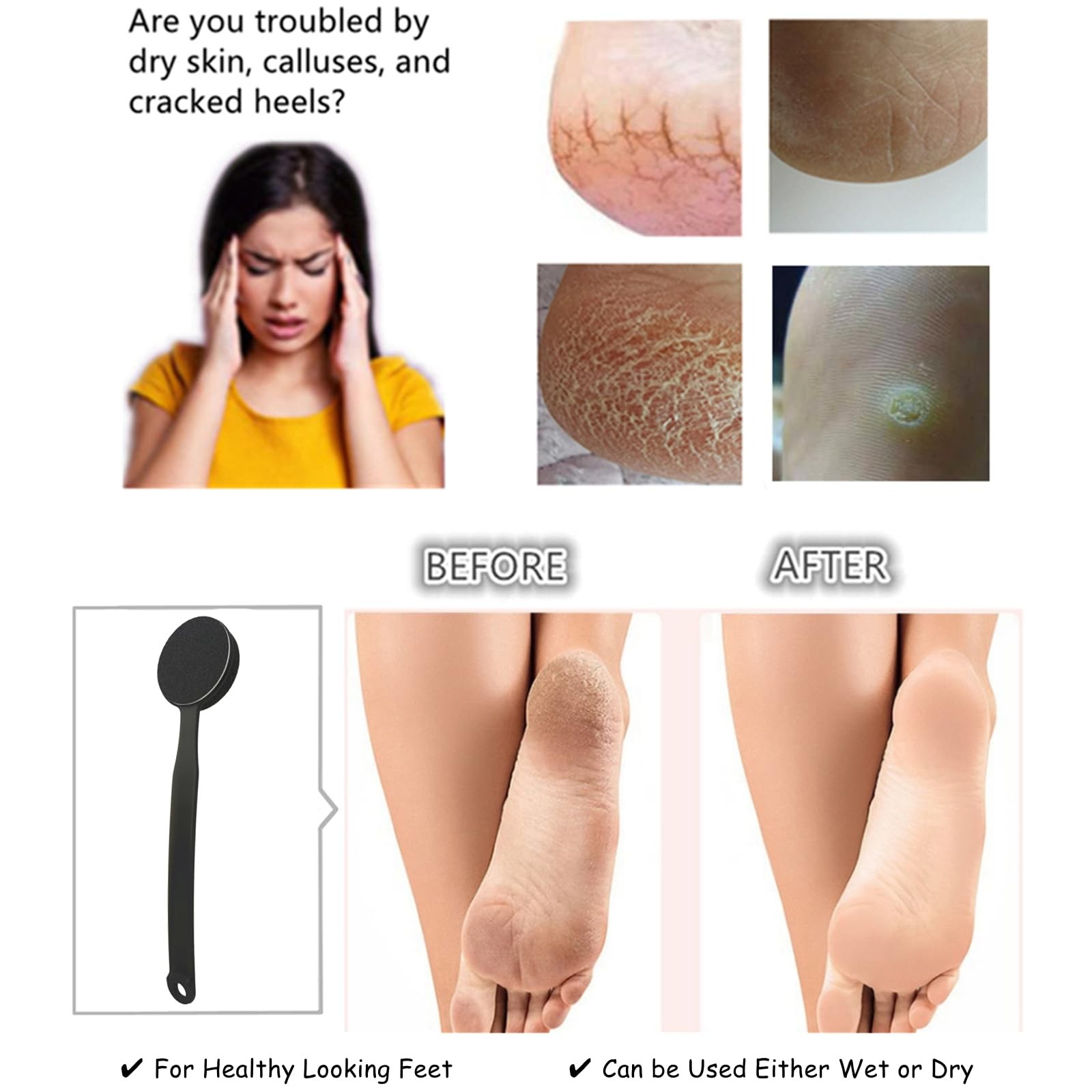 Double Sided Pumice Stone 13.7" Long Handle - Callus Remover & Exfoliator
