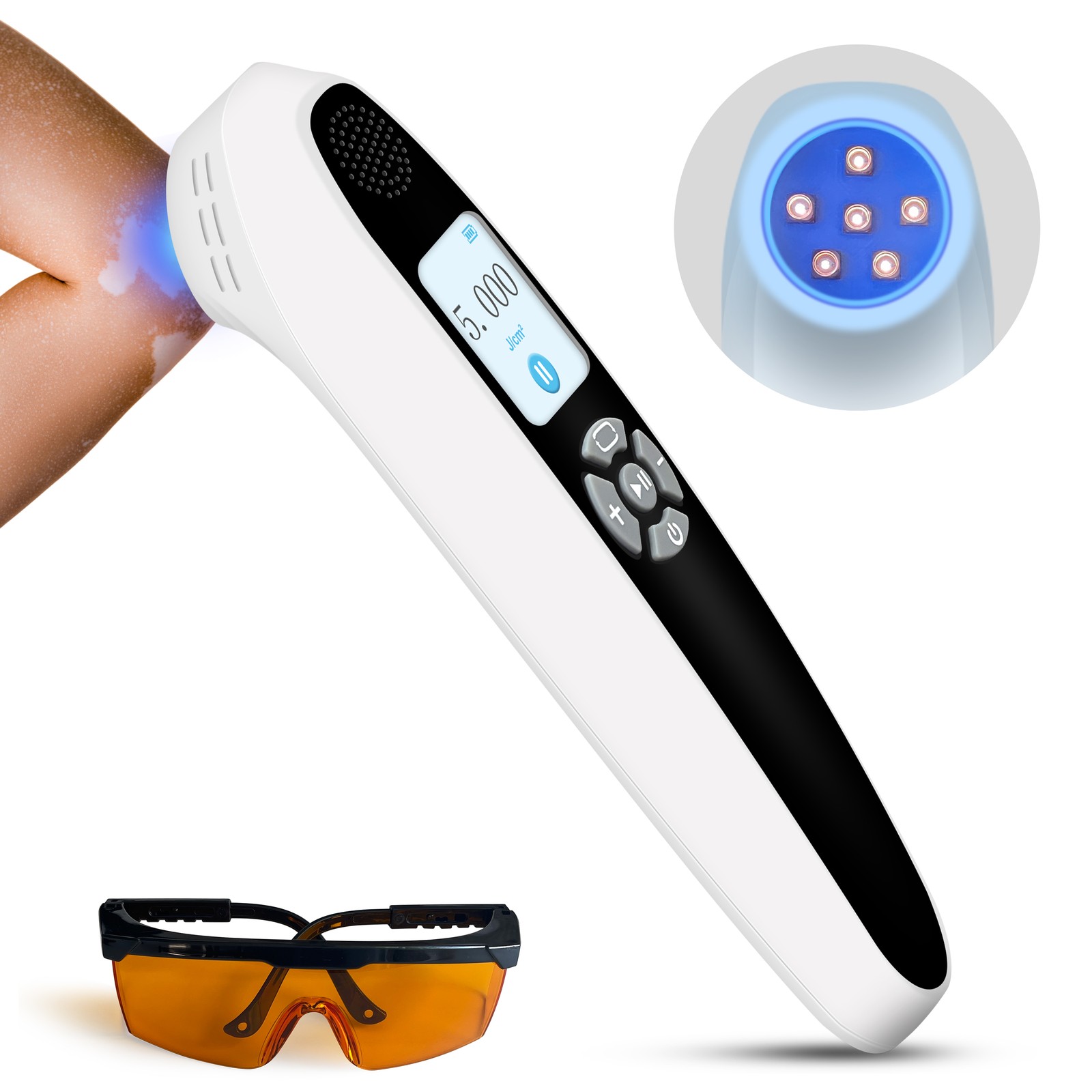 308nm UVB Phototherapy Device 6 Diodes 35mW Narrowband for Face Hand Skin Repair