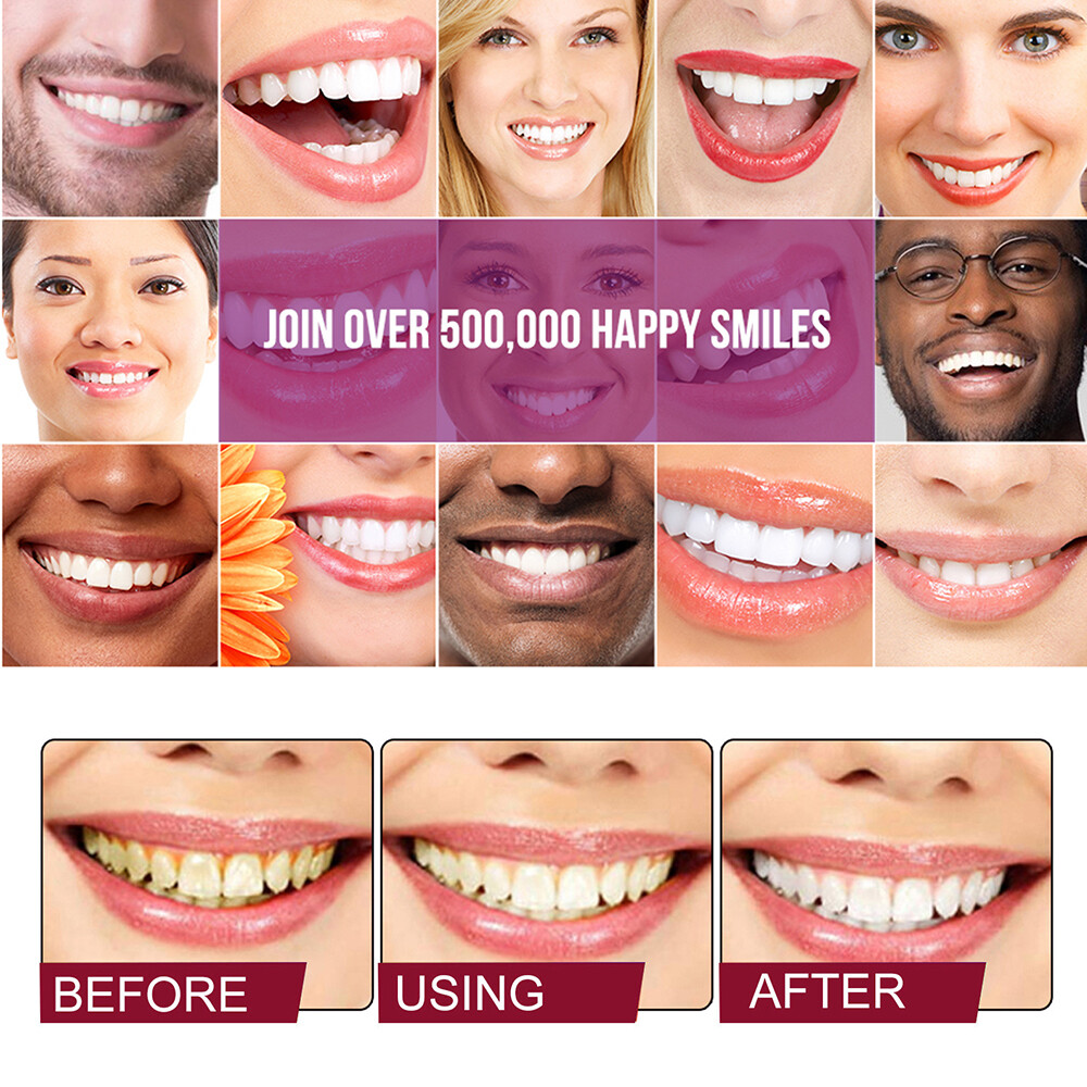 Sp-6 Probiotics Whitening Toothpaste Brightening & Breath Removing Toothpaste US