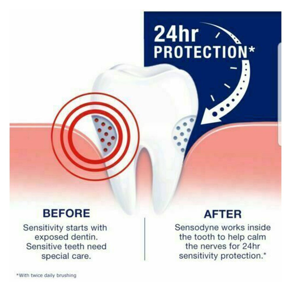 Sensodyne Fluoride Toothpaste ORIGINAL Plus 100g x 1EA * Help to reduce plaque*