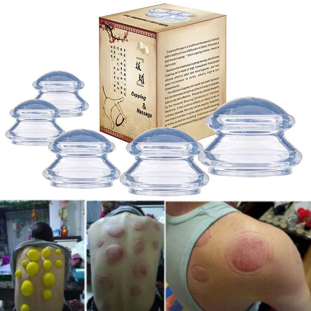 2-7 Cups Cupping Therapy Set Glass Silicone Suction Massage For Face Body US