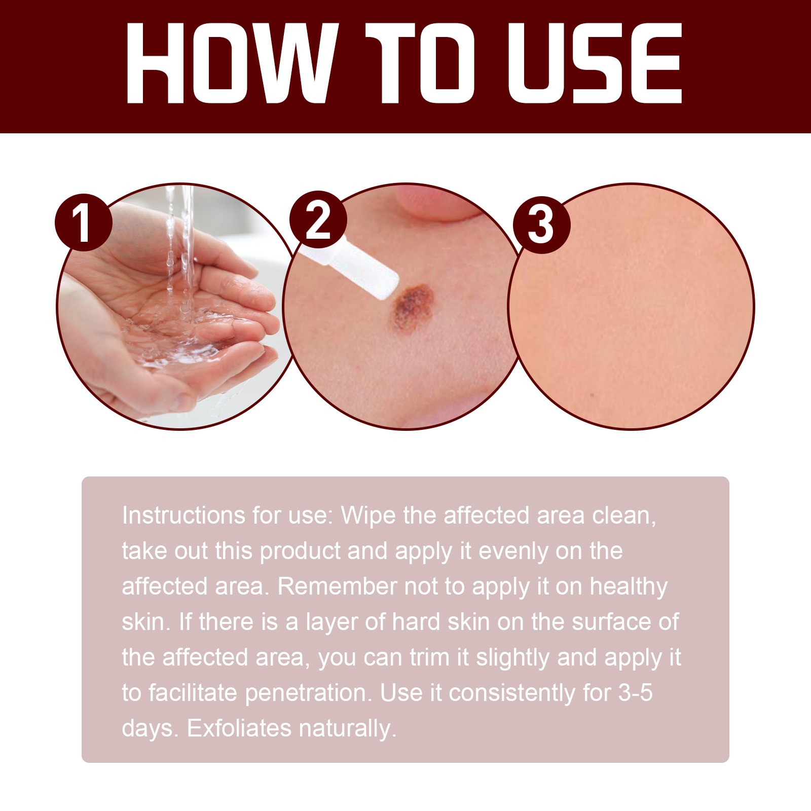Professional Skin Tag Remover Pen with Gentle Formula for Smooth Skin at Home