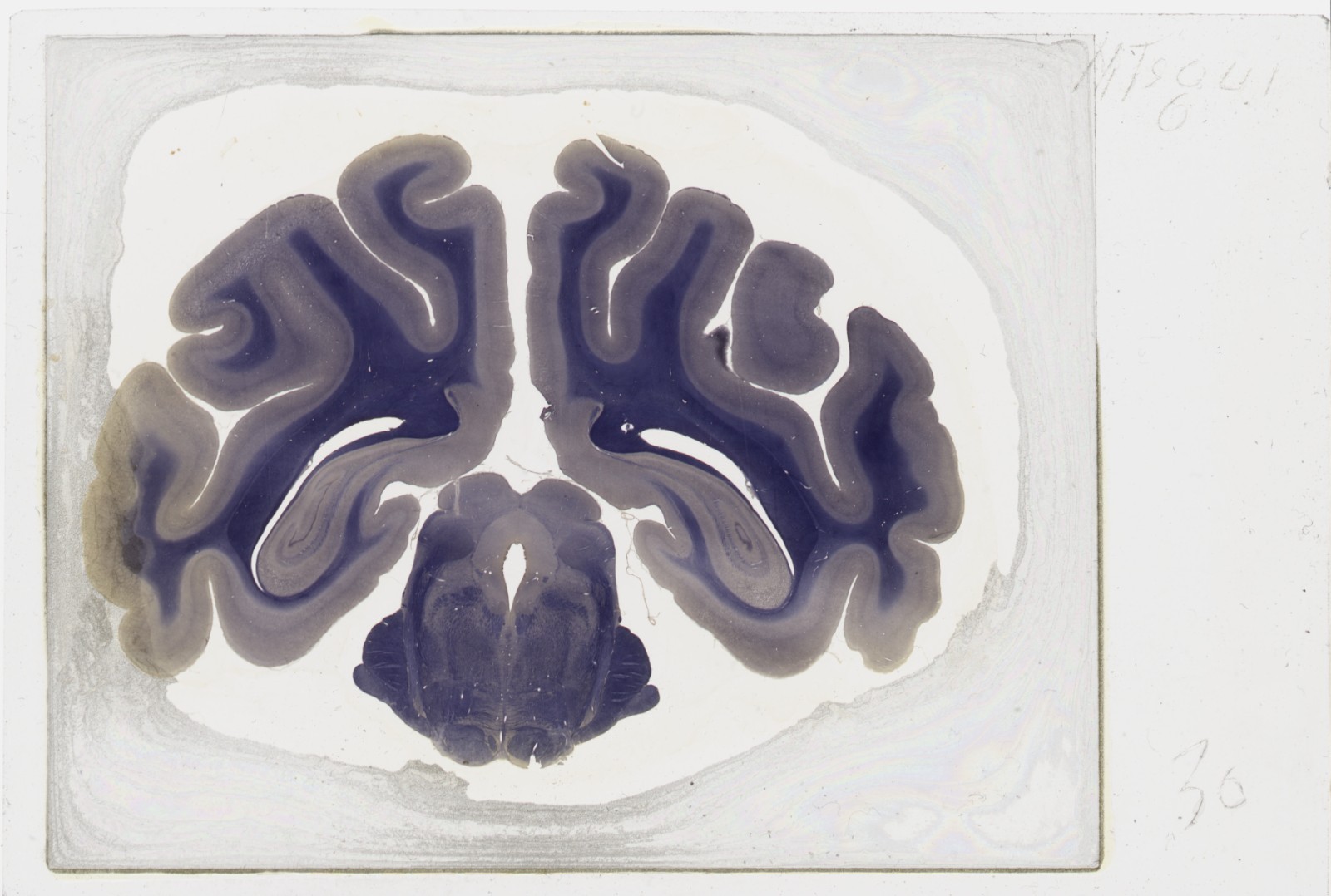 Rhesus Monkey Brain Oversized Microscope Slide - Free worldwide shipping!