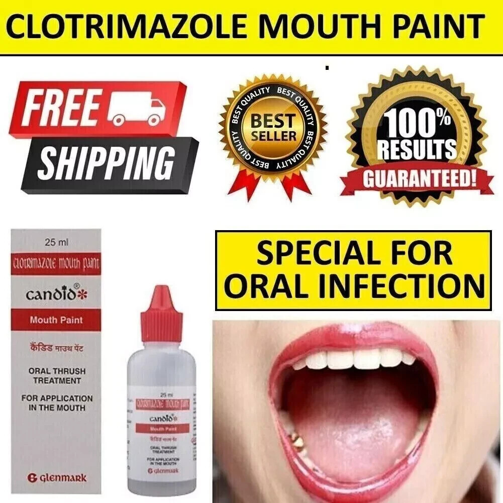 CANDID MOUTH PAINT FOR ORAL THRUSH TREATMENT FOR KILLS FUNGAL INFECTION 25ml US