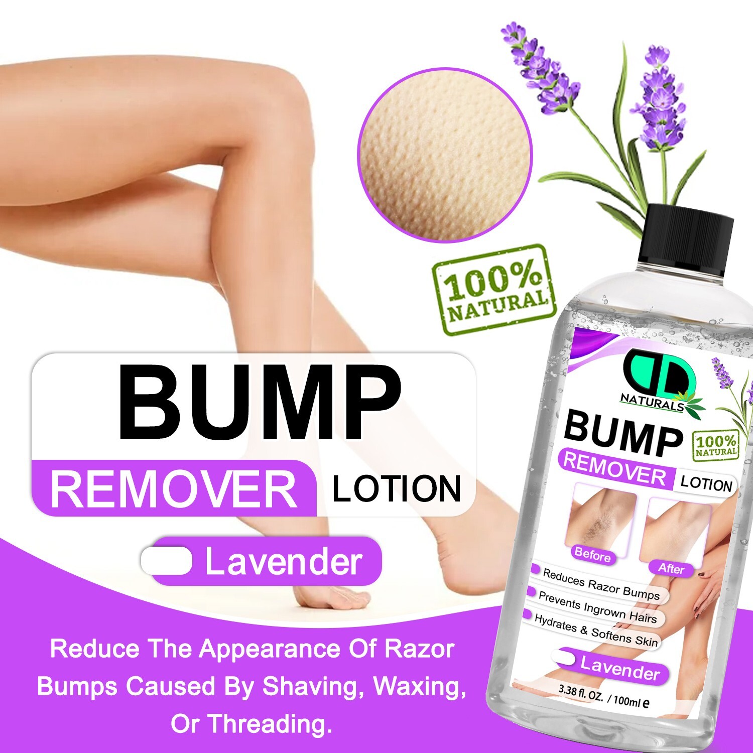 Bump Remover Lotion | Reduces Razor Bumps & Prevents Ingrown Hairs For All Skin