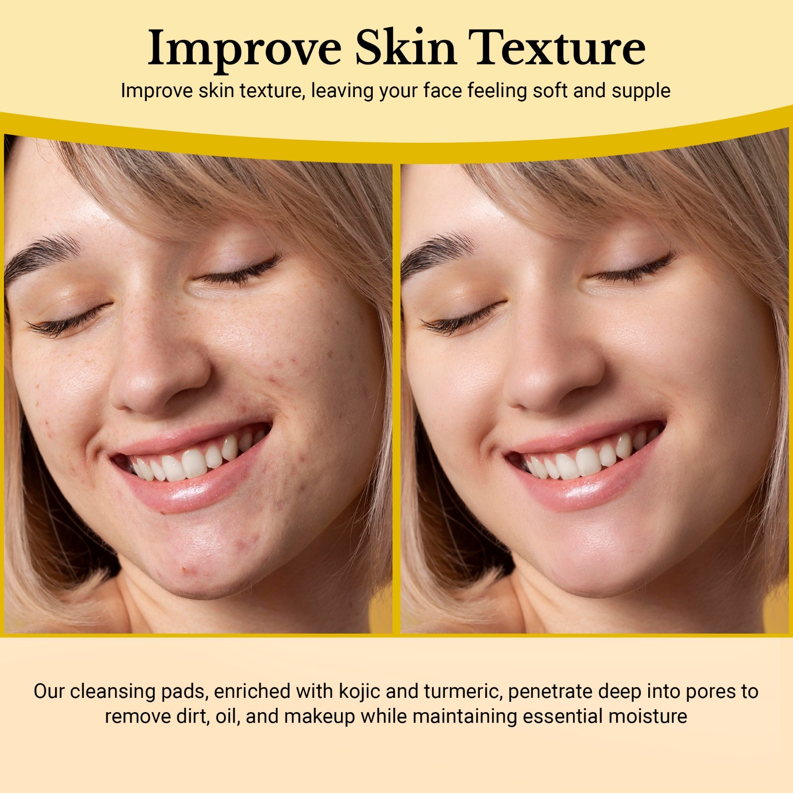 turmeric kojic acid cleansing pads